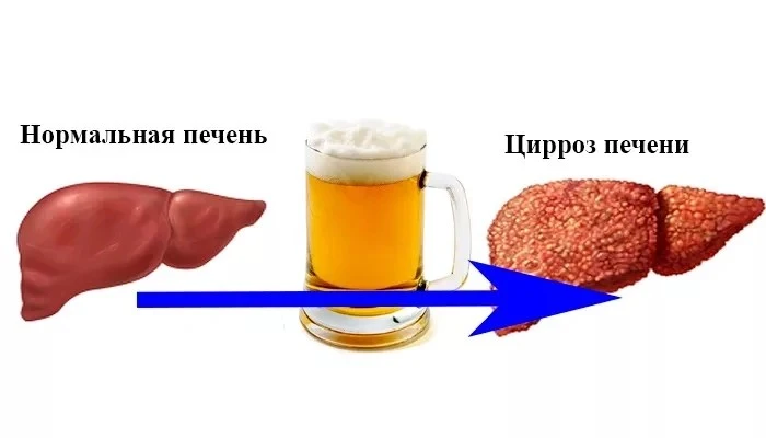 Печень – единственный внутренний орган, который не болит, когда с ним что-то не так. В ней нет болев