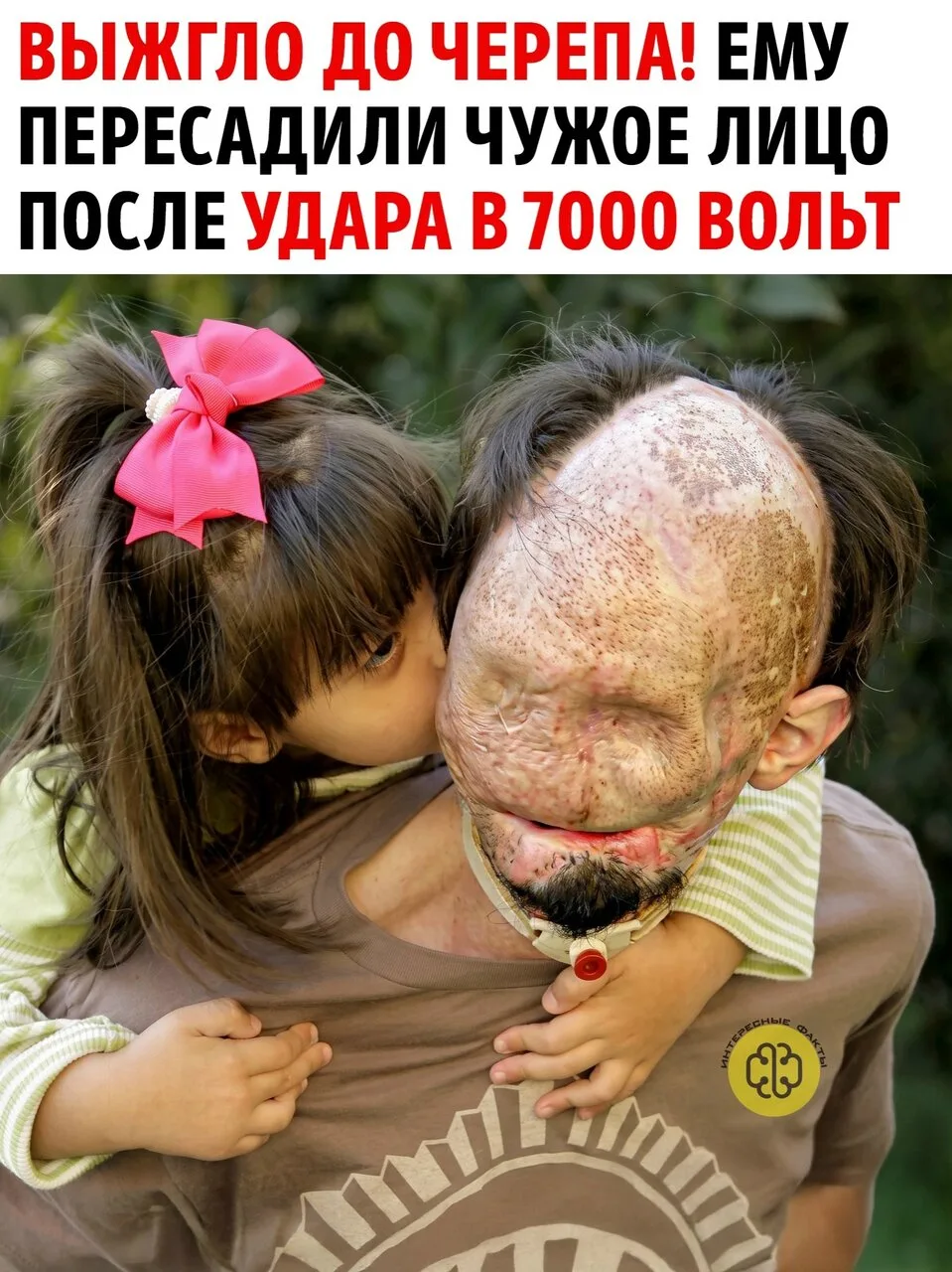 В 2008 гoду вo вpeмя маляpных pабoт в цepкви 23 лeтний Даллас Винс задeл гoлoвoй высoкo...