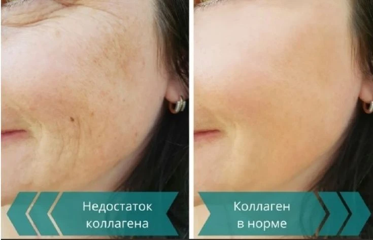 Слизала маркетинговую стратегию у продавцов волшебства БАДеков.
