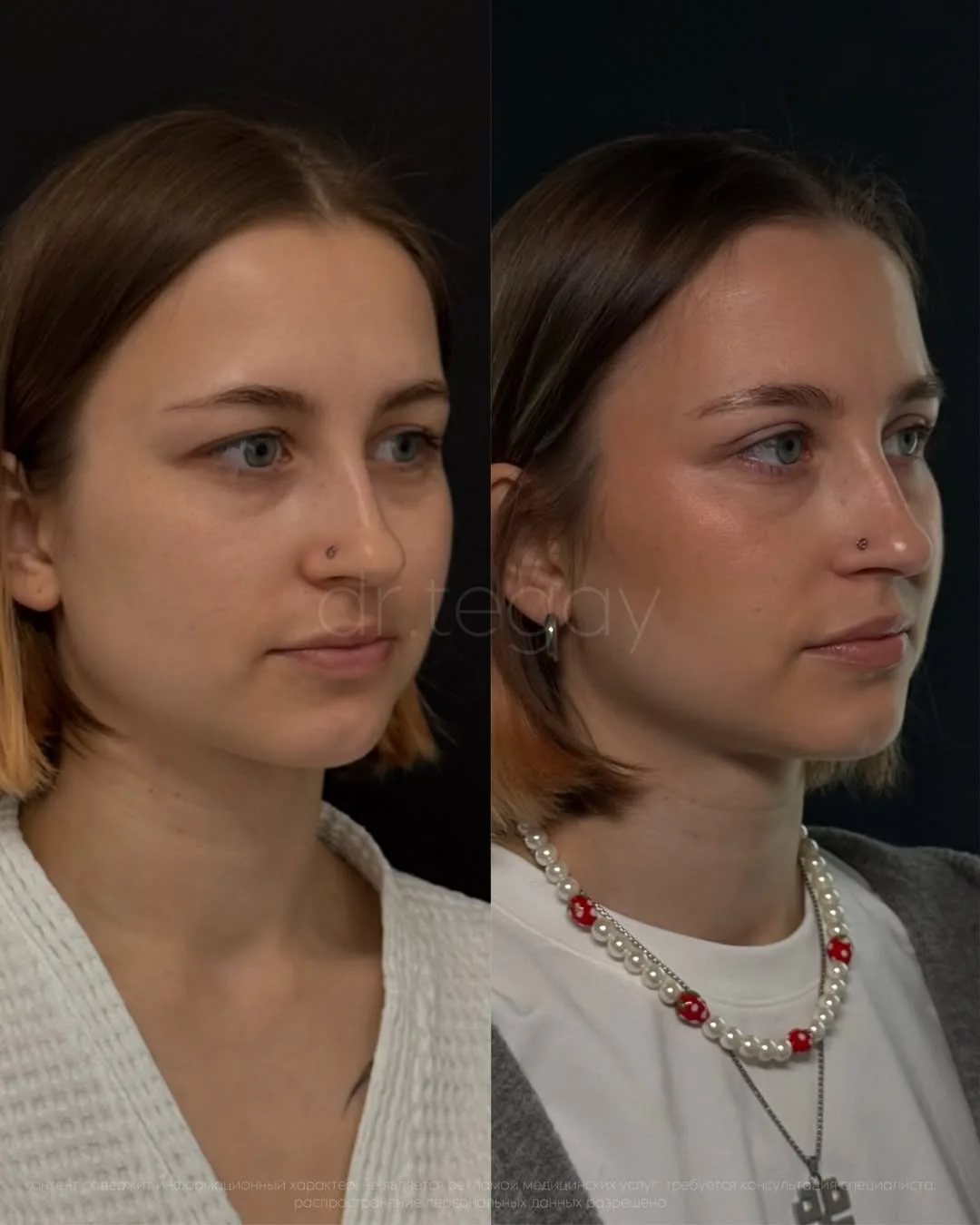 «Я думала, это просто такая форма глаз»
