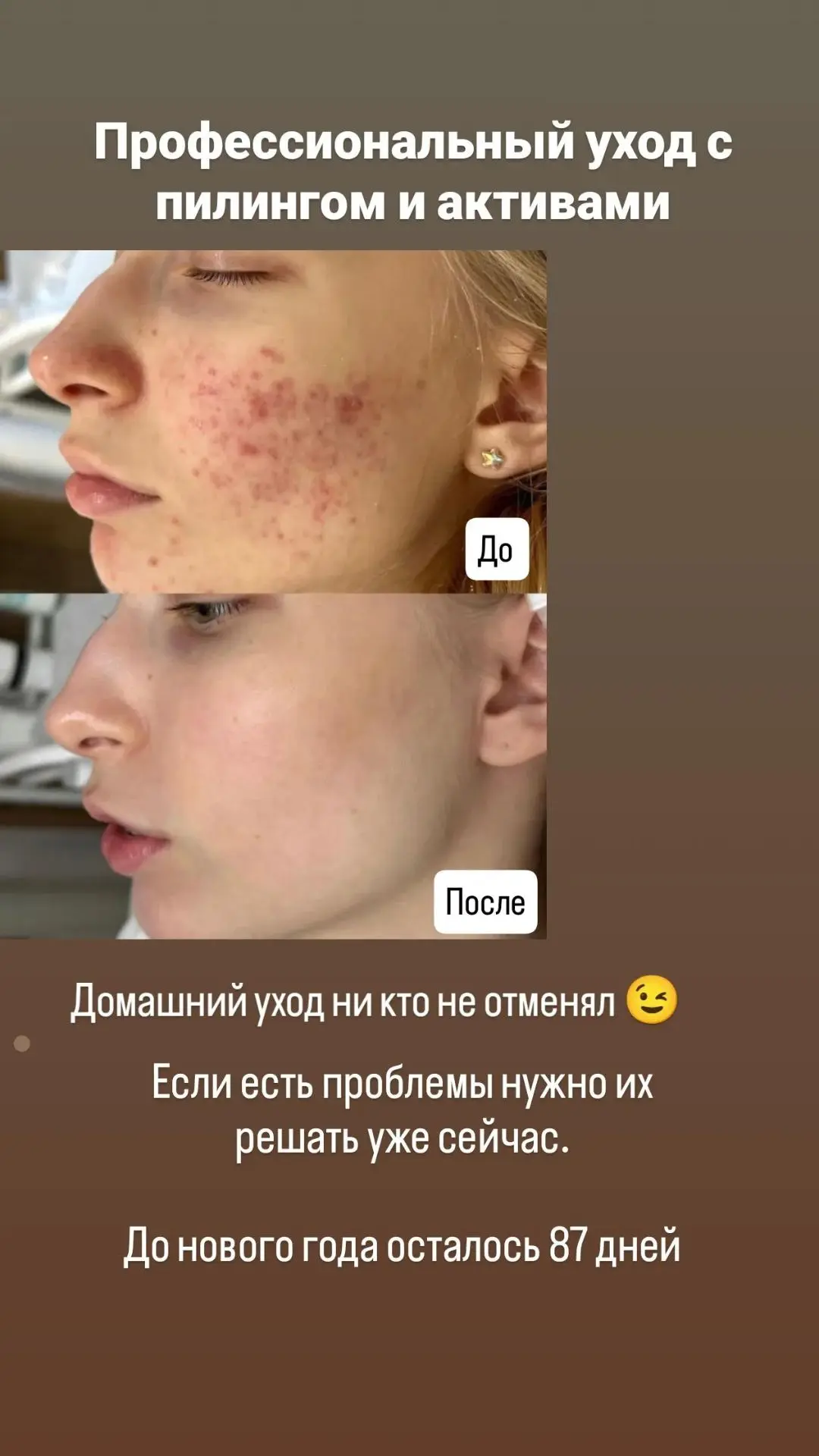 Профессиональный уход который многие не дооценили, а он вон как работает 👌