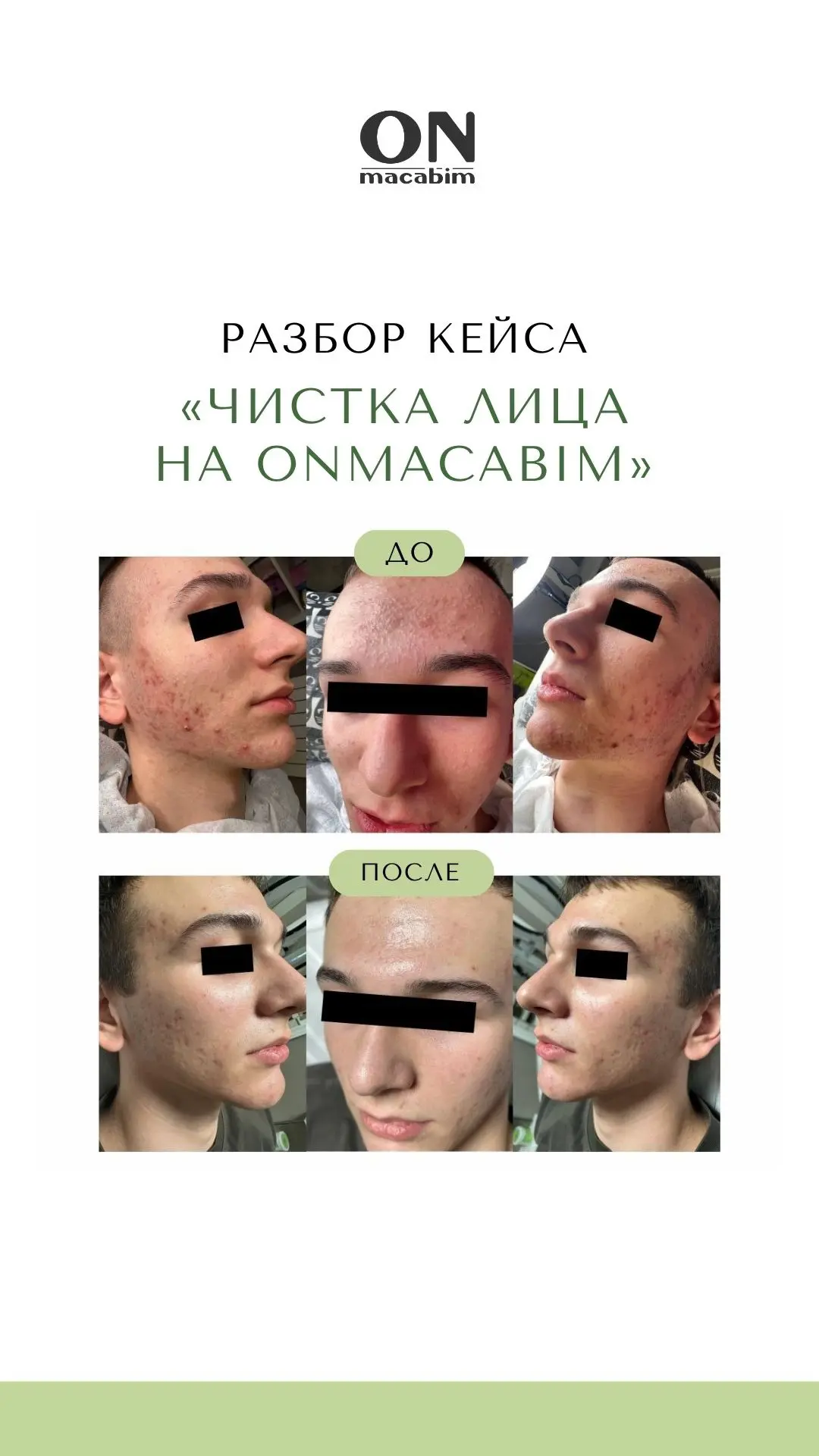 Система: как получить гарантированный результат в процедуре 🧾