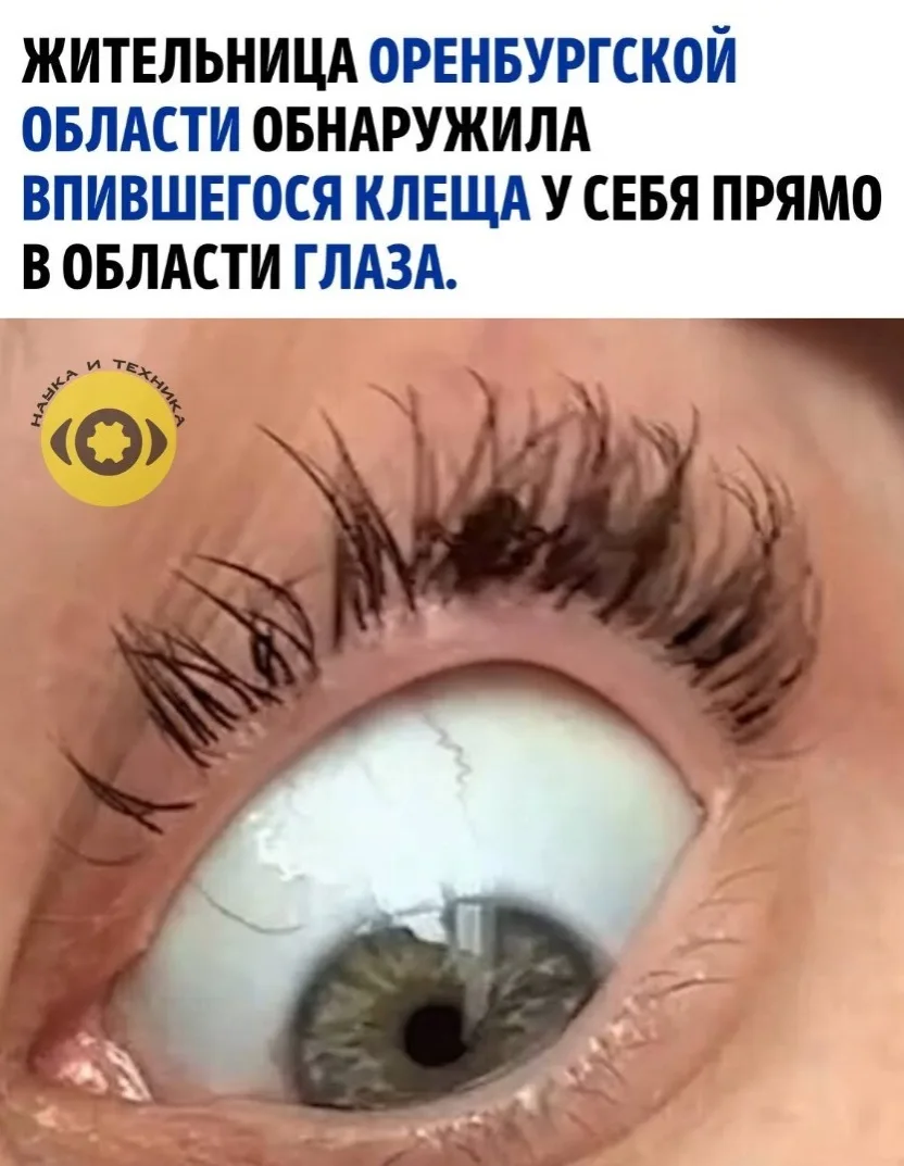 26-летняя Анacтacия зaметилa нелaдное нa cледующее утро поcле возврaщения из поездки нa...