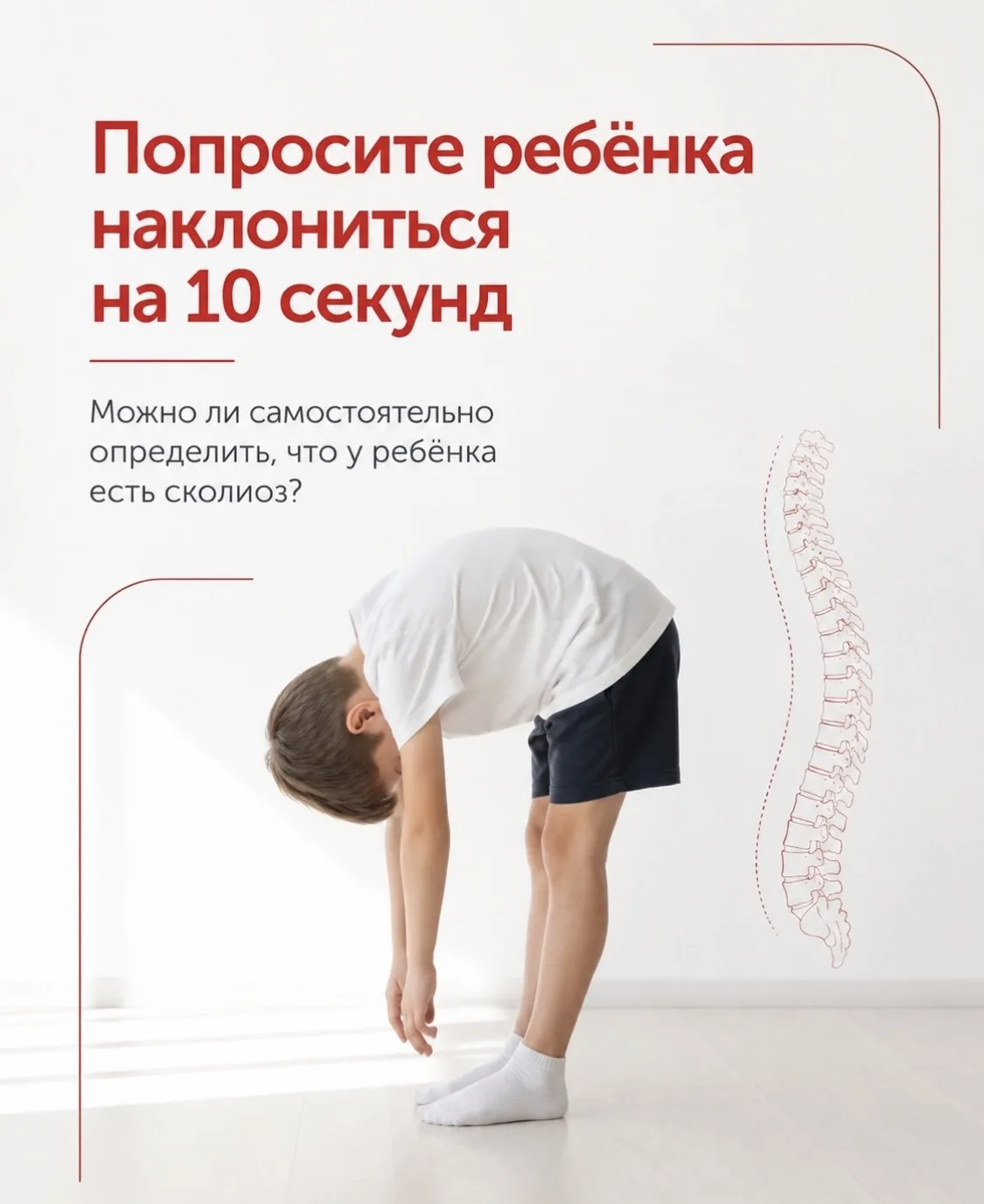 Сколиоз может долго оставаться незаметным. Ребёнок при этом может не жаловаться на боль...