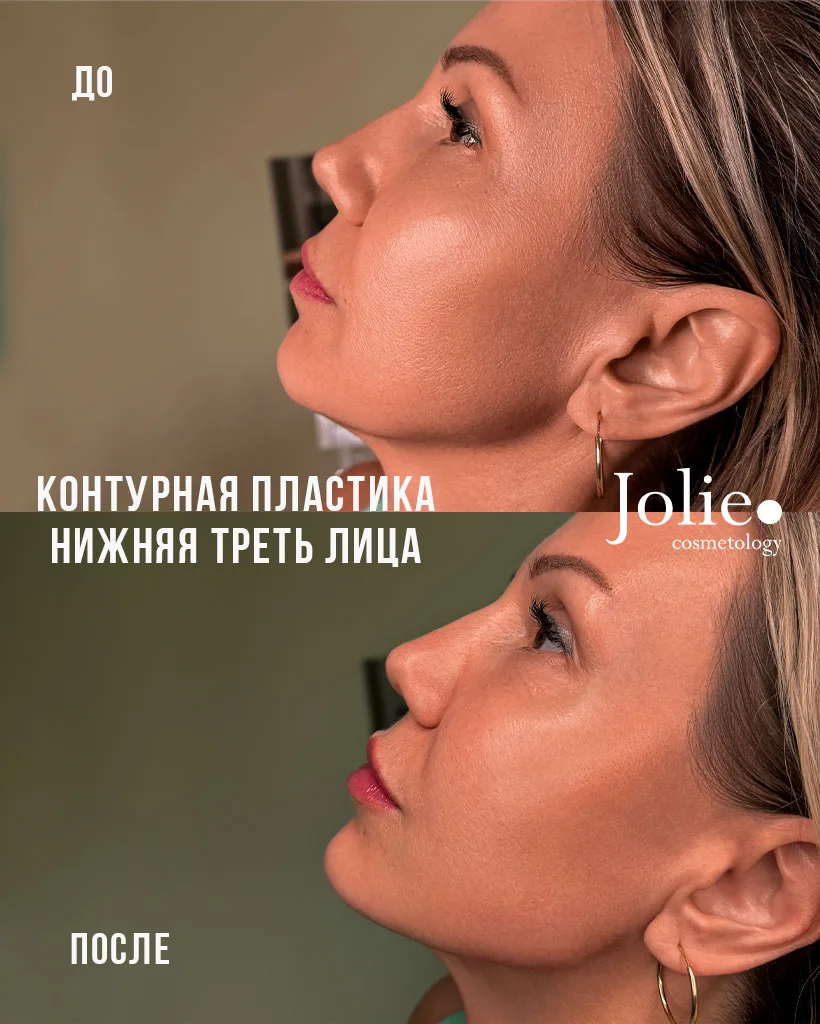 Изображение 1 к публикации «Центр косметологии Jolie»