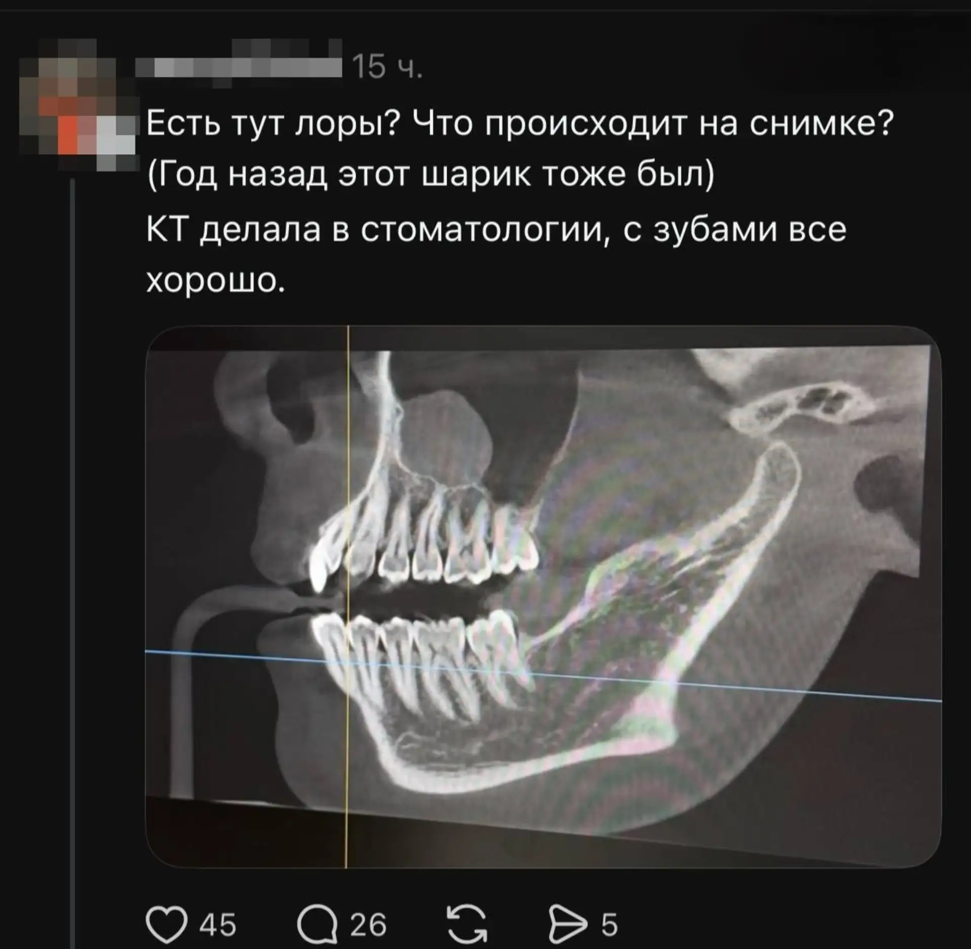 📢 Экономия на врачах: новое поколение ищет докторов среди друзей в соцсетях. Вместо пл...