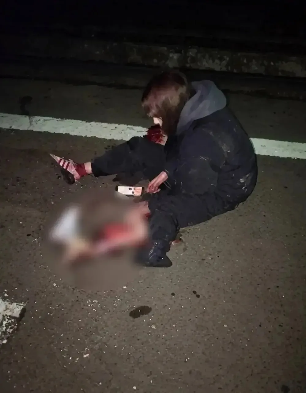 😰В Подмосковье поезд отрезал девочке-зацеперше ногу.