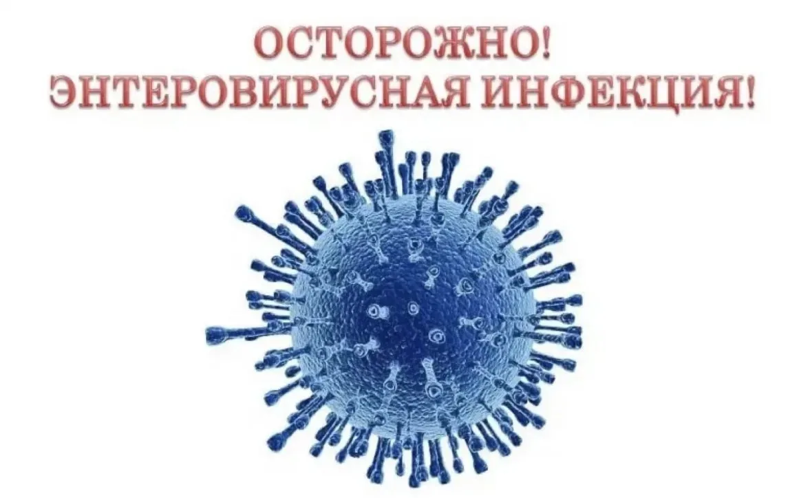 Осторожно❗❗❗Энтеровирусная инфекция! Памятка для родителей