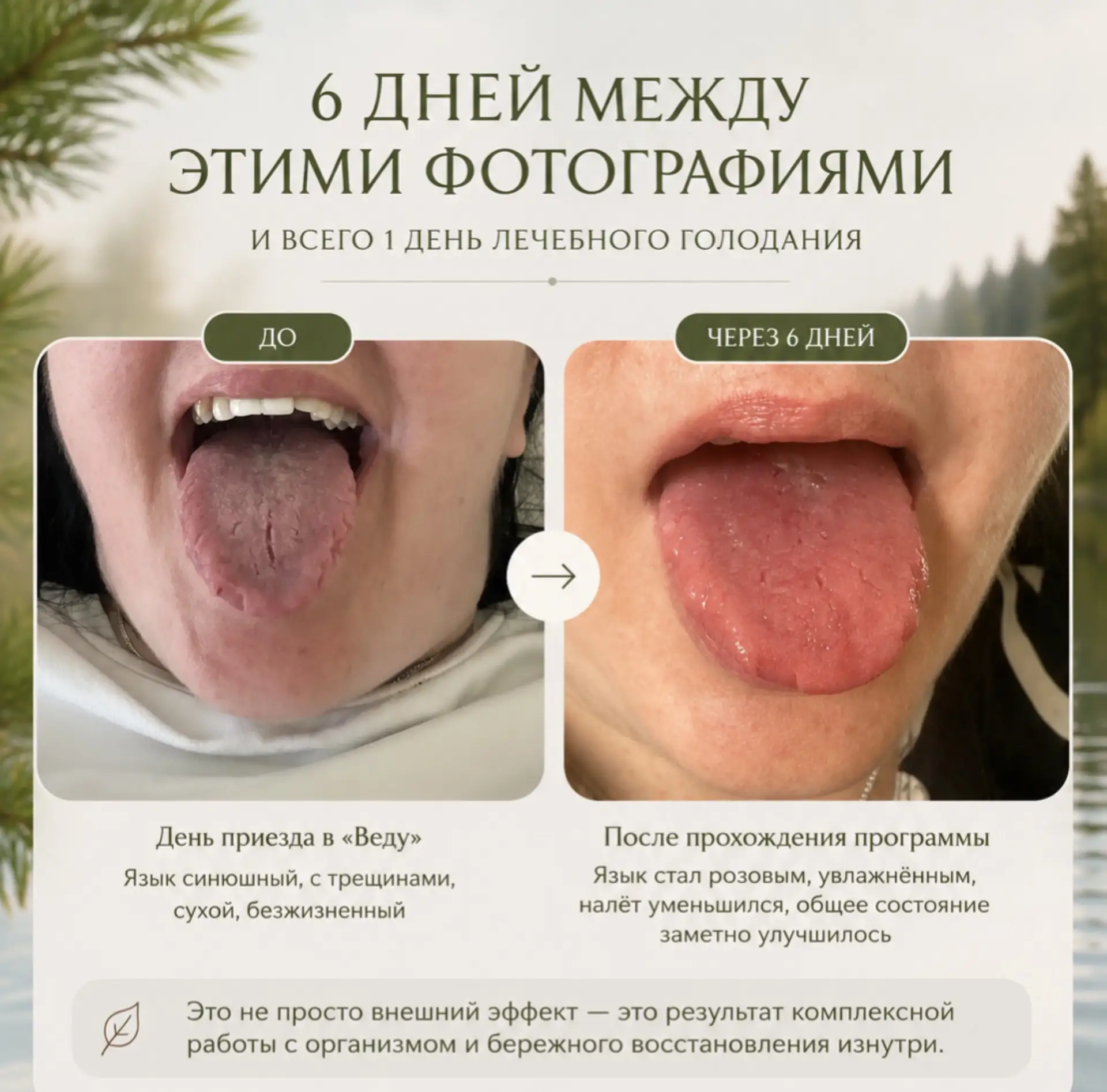 Всего 6 дней. И только один день голода. Посмотрите на эту разницу 🔥