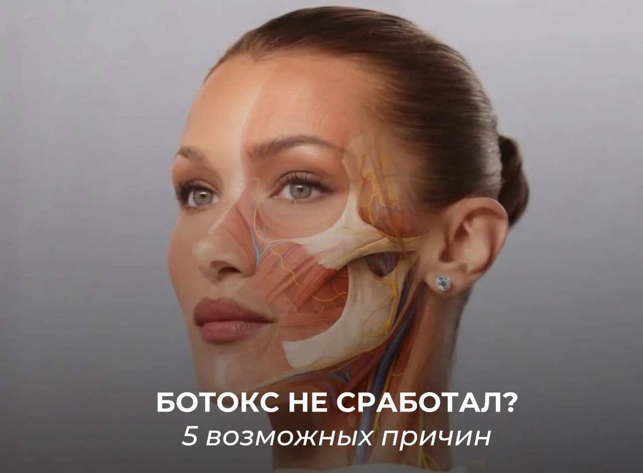 Может ли ботокс не подействовать?