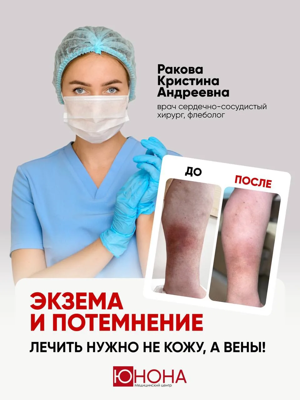 Пытались лечили кожу, а нужно было вены 📌