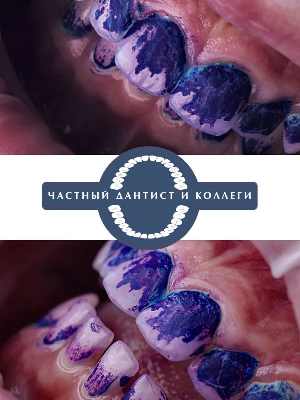 Продолжаем рубрику #стоматологическийдетектив