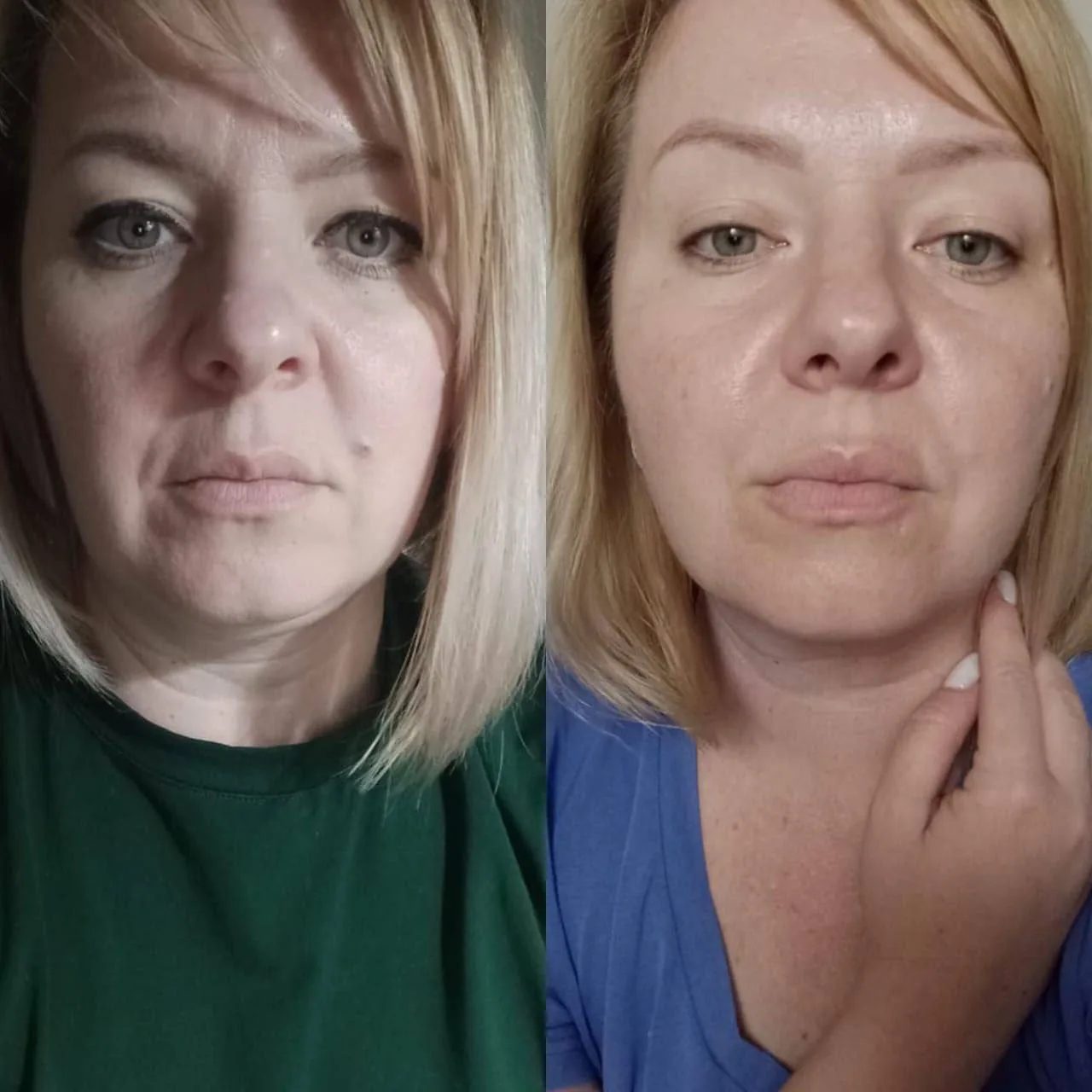 🔥 РЕЗУЛЬТАТЫ ПРИЁМА COLLAGEN PEPTIDES — СМОТРИМ В ОТЗЫВАХ! 🔝
