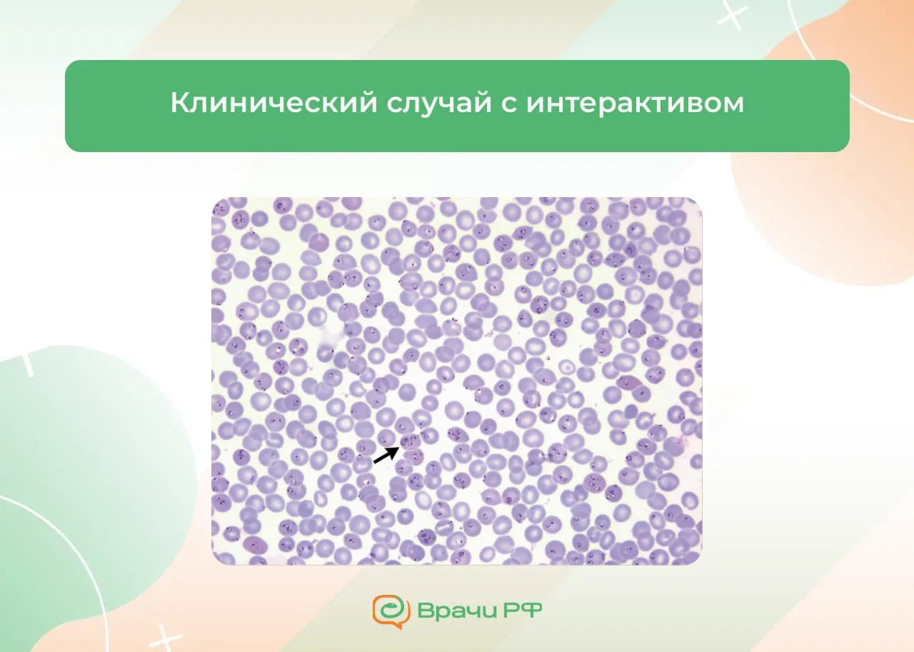 🧠 Мужчина с лихорадкой и нарастающей слабостью. Клинический случай с интерактивом