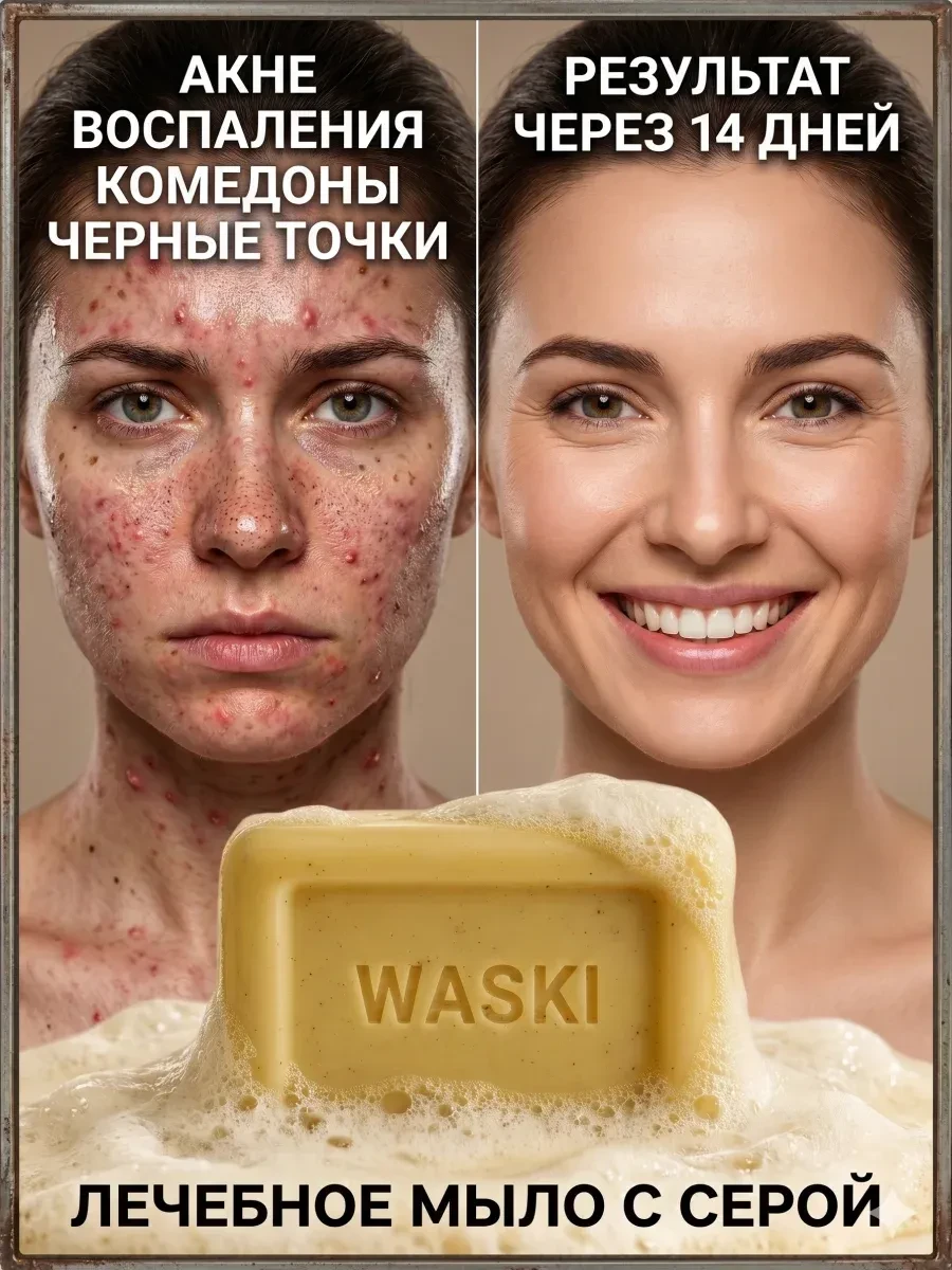 ⚡️ Мыло - пенка от прыщей и анти акне для проблемной кожи тела, Waski