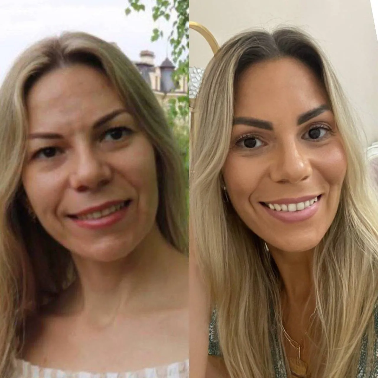 У меня тоже был живот, второй подбородок, отеки и лишний вес 💔