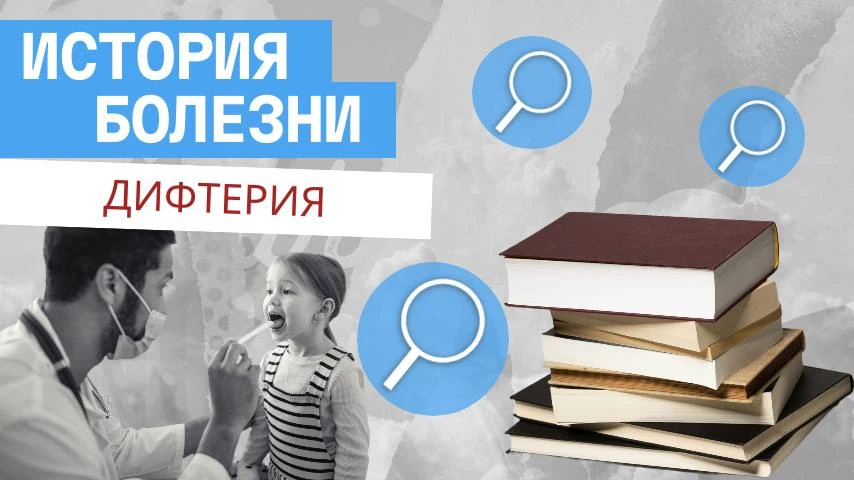 История болезни. Дифтерия 

💡Дифтерия – острое инфекционное заболевание, вызываемое дифтерийной пал