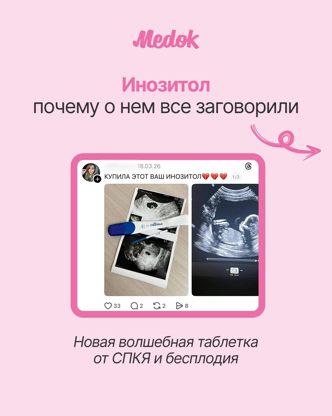 Инозитол при СПКЯ — сейчас одна из самых обсуждаемых тем в соцсетях.