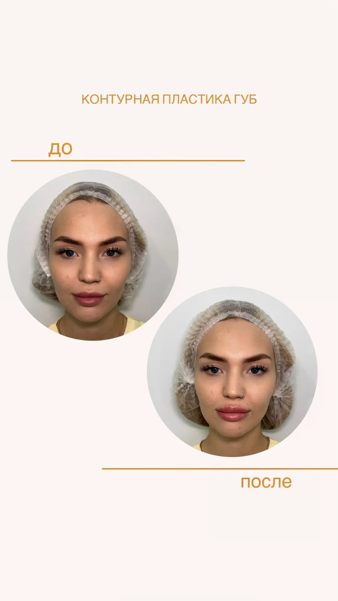 Губы решают первое впечатление за 3 секунды🤩