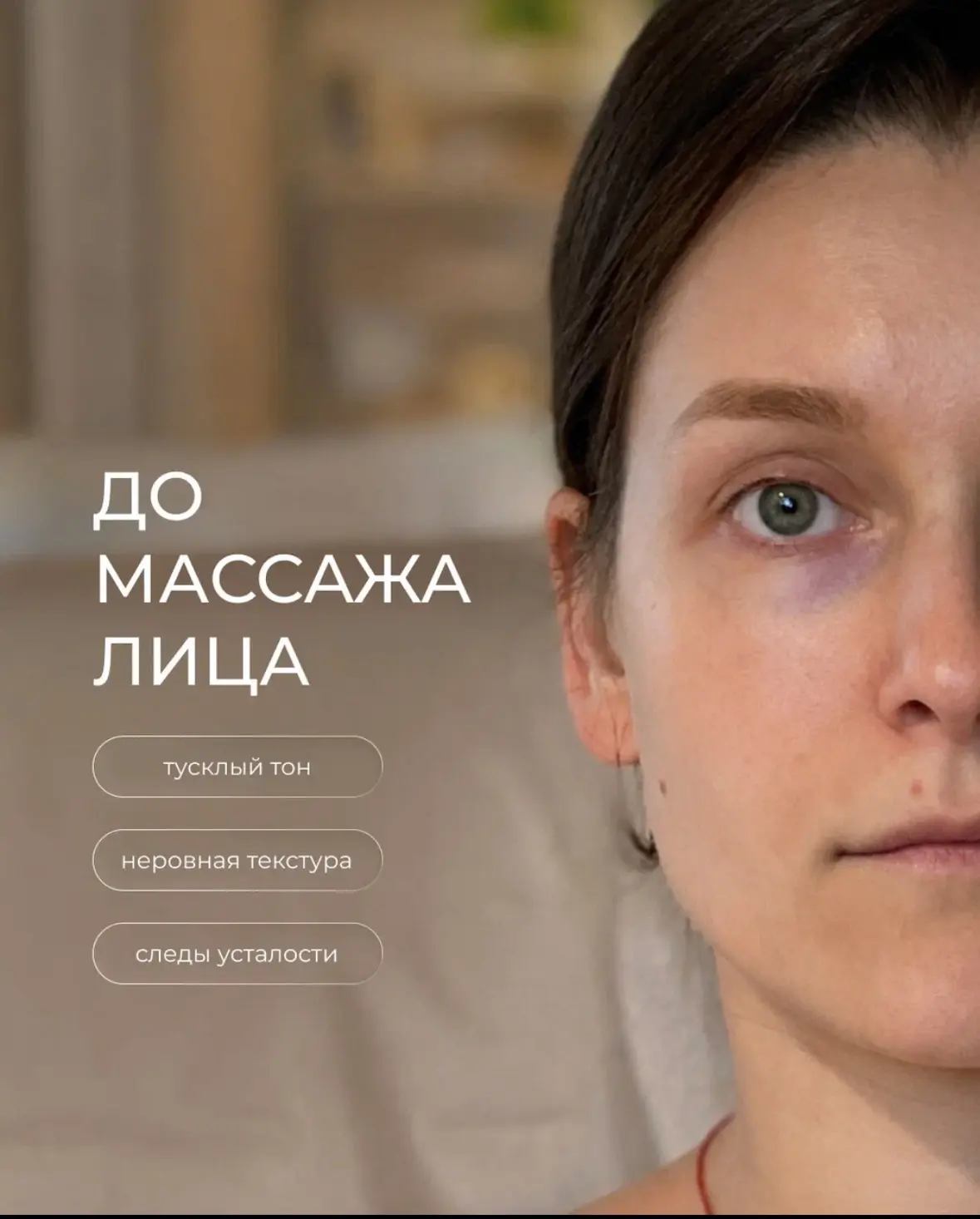 Посмотрите, как меняется состояние кожи после одного сеанса 👆