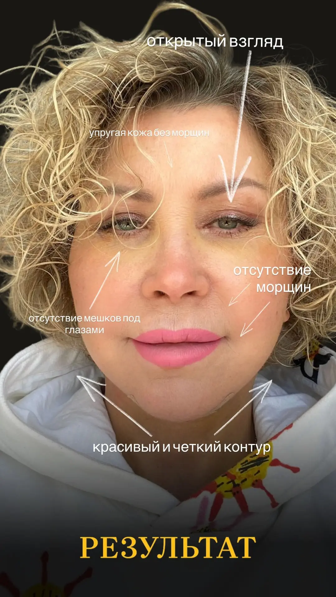ТОТАЛЬНОЕ ОМОЛОЖЕНИЕ ❤️
