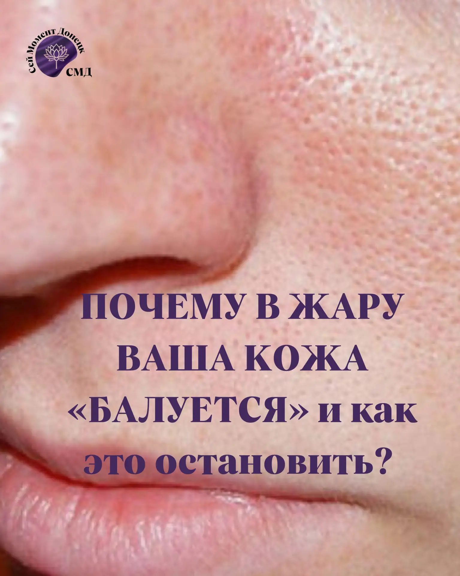 ⁉️ ПОЧЕМУ В ЖАРУ ВАША КОЖА «БАЛУЕТСЯ» и как это остановить? 💥