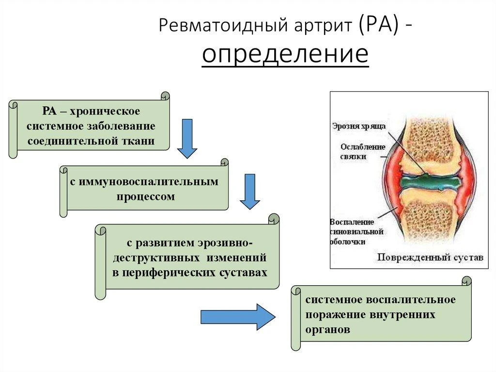 РЕВМАТОИДНЫЙ АРТРИТ. ЧАСТЬ 3