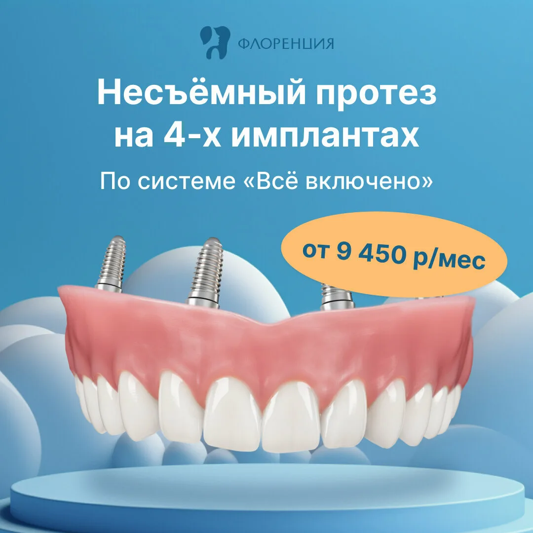 Все зубы сразу на 4-х имплантах от 94.500 ₽ в Москве!  Имплантация зубов всей челюсти сразу с протез