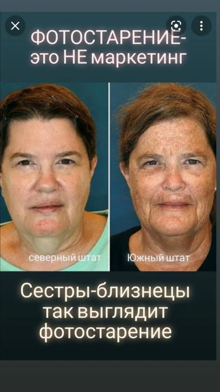 как же быть с лучами UVA, которые повреждают как минимум коллаген и эластин и ускоряют старение на г