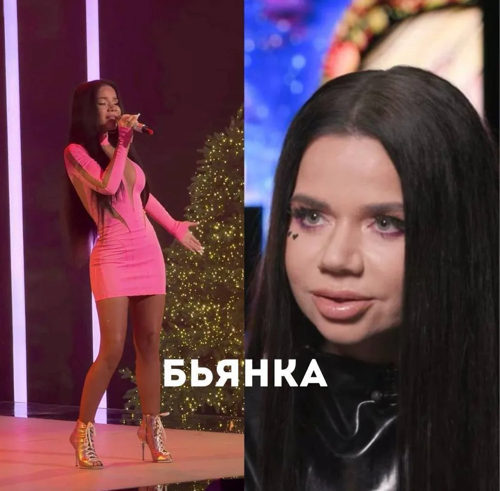 ОТЕКИ: Бузова, Бьянка, Асти — почему ОНИ не могут их убрать?🤔