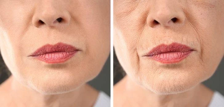 👄 Губы уже не те! Заметили что с возрастом губы теряют свою привлекательность?