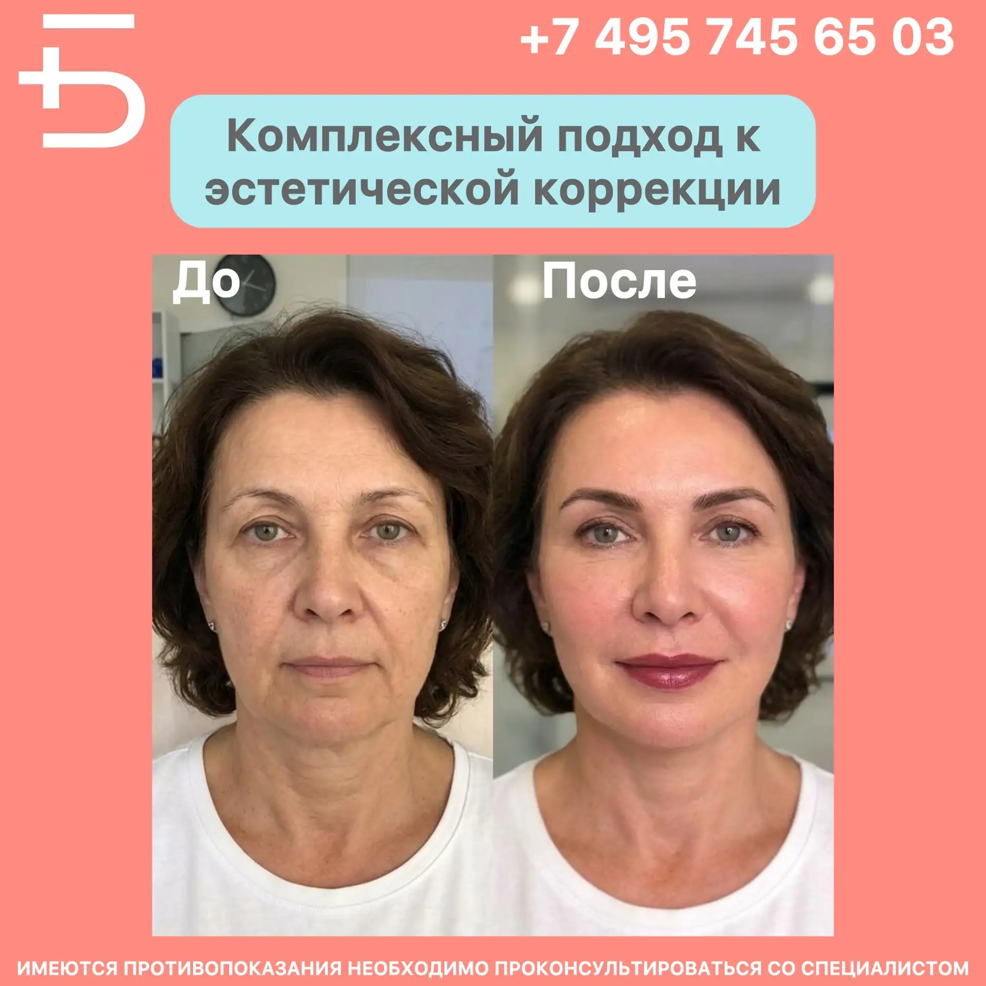 🤔🔎 Многие пациенты обращаются к нашим косметологам с желанием улучшить внешний вид, но без чёткого п