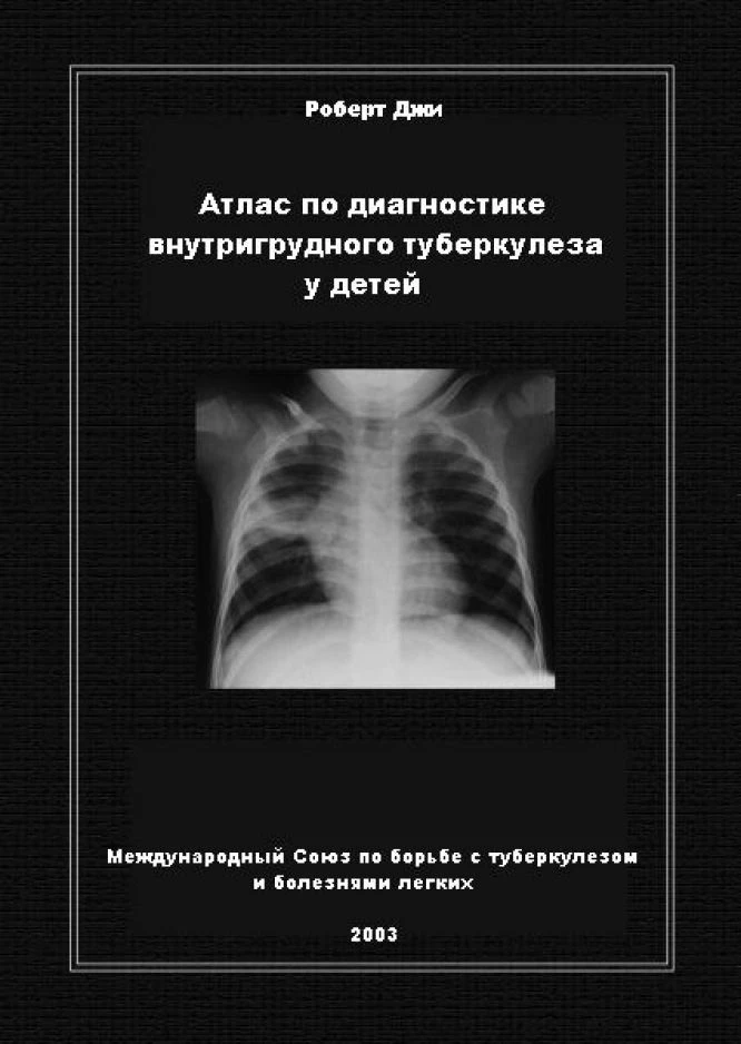 📗 Атлас по диагностике внутригрудного туберкулеза у детей