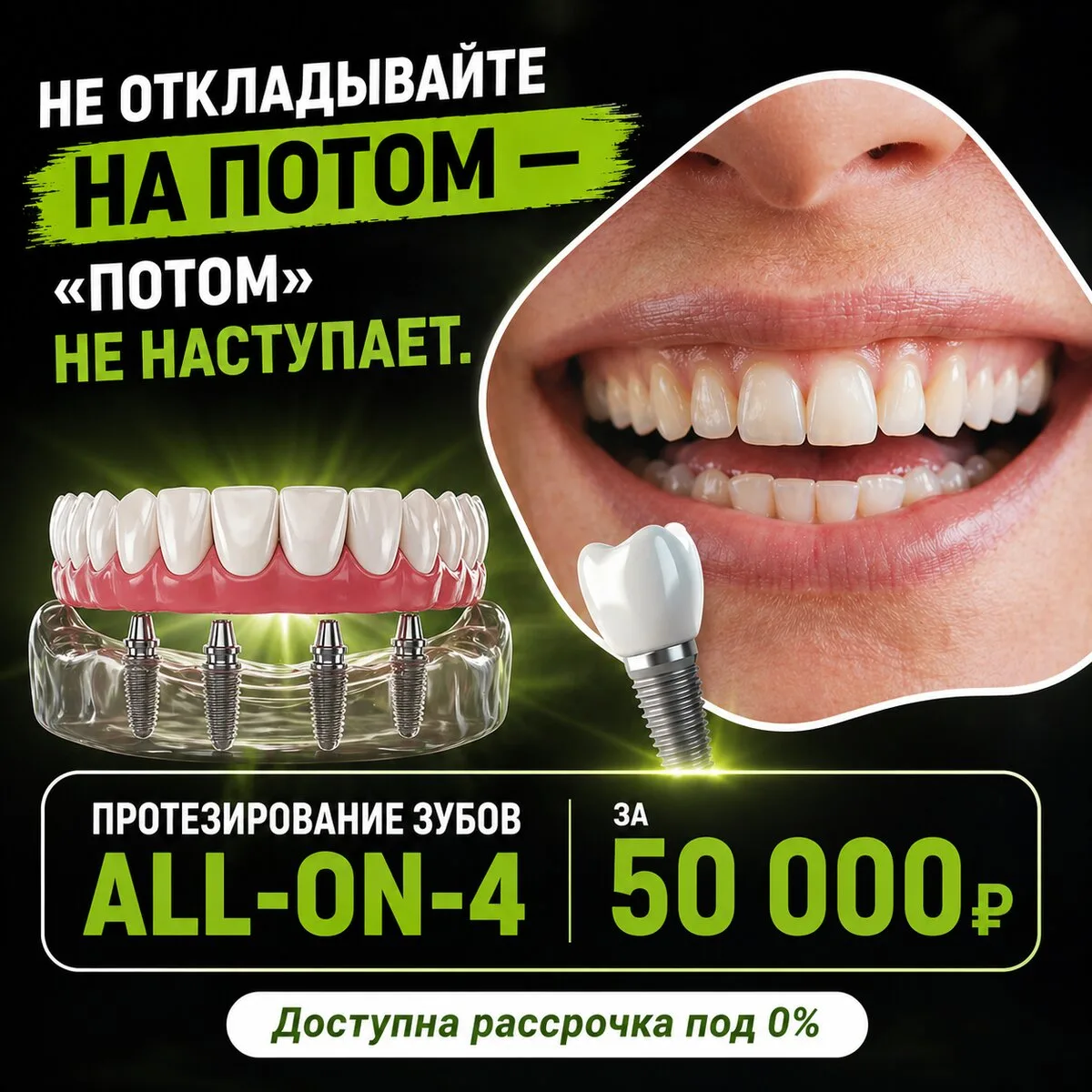 Имплантация зубов на 4 имплантах в Тюмени!  Все зубы на 4 имплантах за 50 000 ₽⚡  Мгновенная имплант