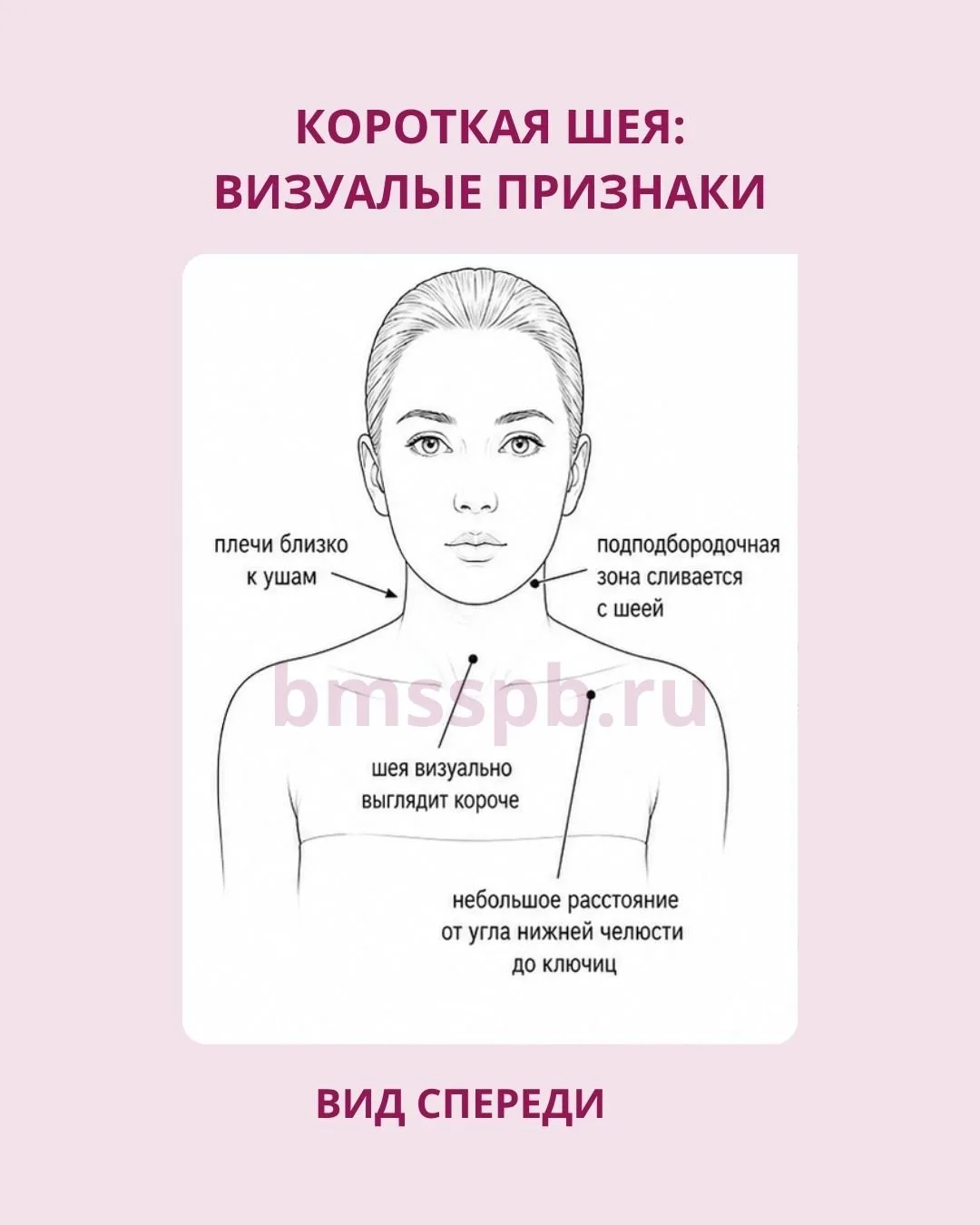 КОРОТКАЯ ШЕЯ: КОГДА ПРОБЛЕМА В СОСТОЯНИИ МЫШЦ