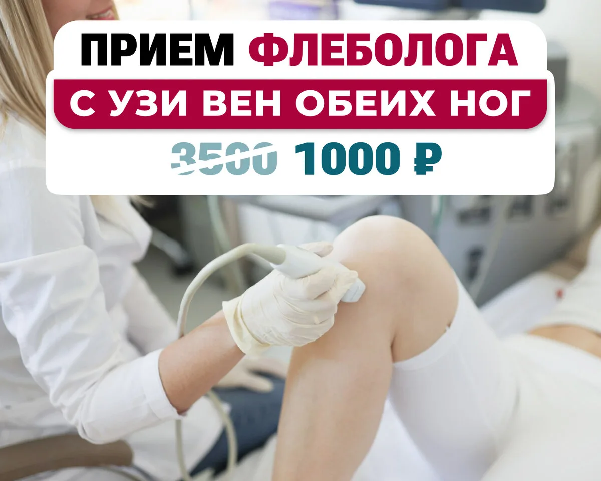 Быстрая диагностика варикоза и тромбоза — лечим бережно.