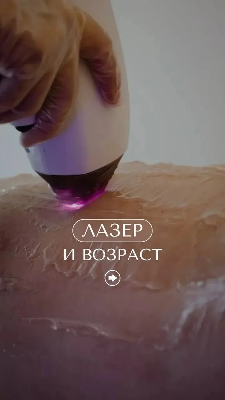 Лазерная эпиляция и возраст👆🏻