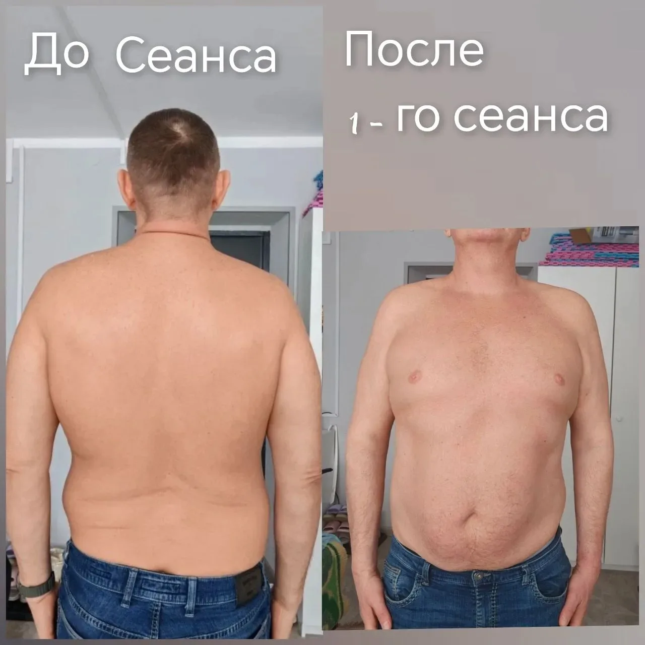 Когда 5 месяцев ада превратились в 1 сеанс 🙌