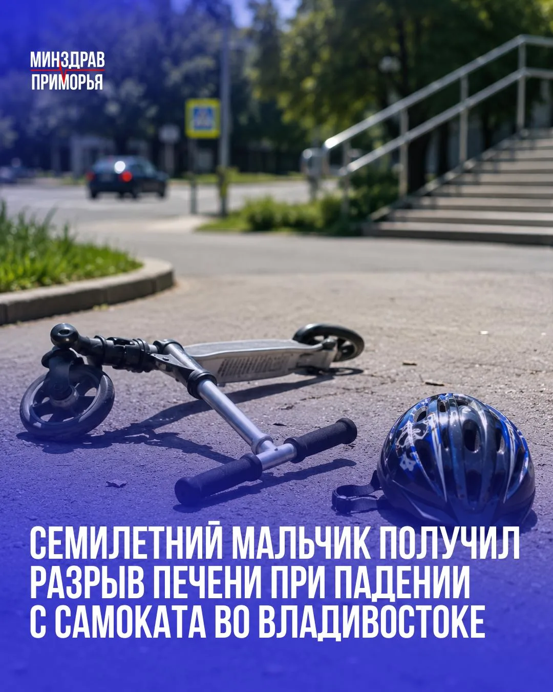 В краевую детскую больницу №1 поступил семилетний мальчик после падения с самоката на б...