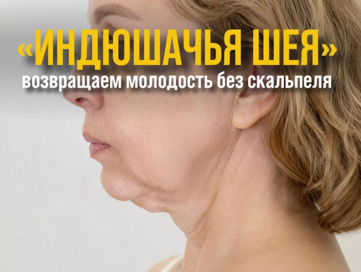 «Индюшачья шея»: причины и можно ли обойтись без операции?

В народе называют «индюшачьей шеей», а в