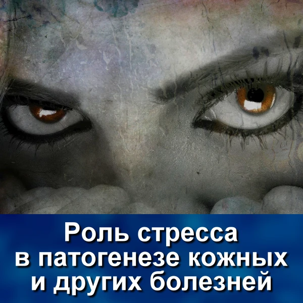 Любой стресс имеет три стадии: активации, адаптации и погибели.