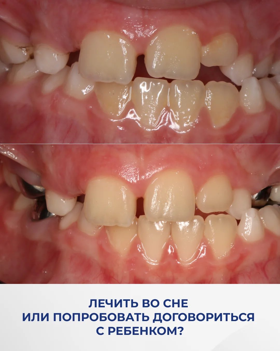 Существует миллион и маленькая тележка способов для адаптации ребенка.
👍 И мы все их используем в Ц