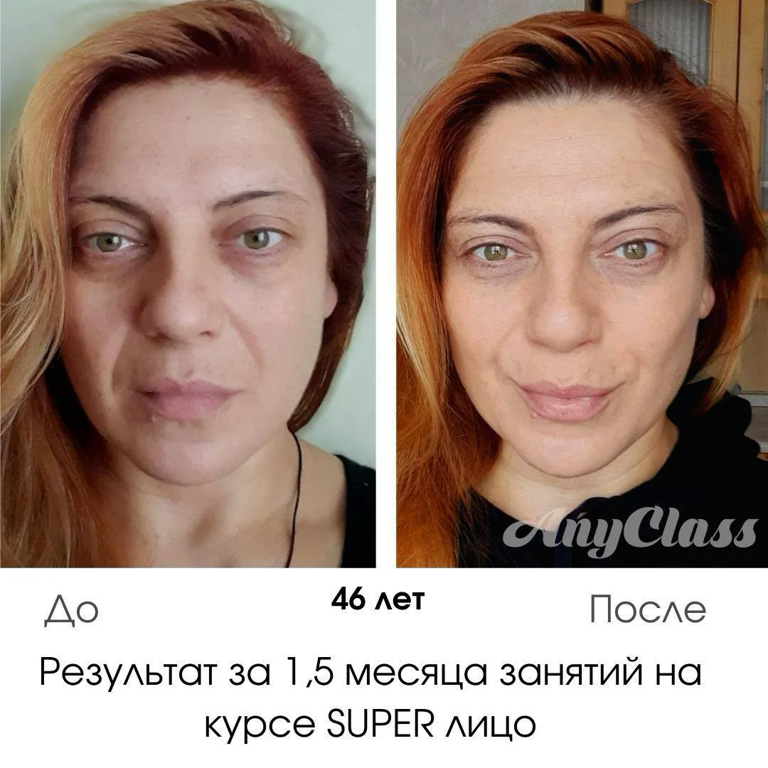 Сейчас все гонятся за острыми скулами и утончённым лицом, и многим кажется, что единственный путь - 