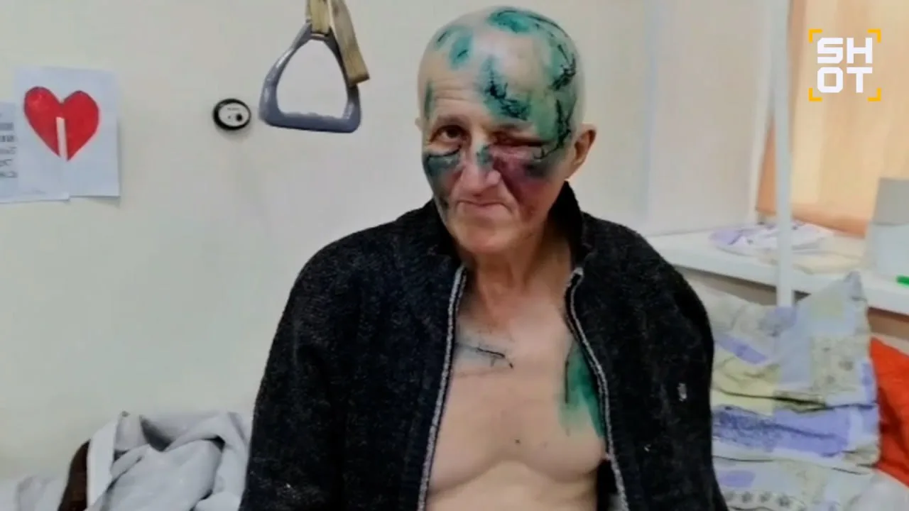 65-летний рыбак из Приморья выжил в схватке с напавшей на него медведицей — отбиваться ...