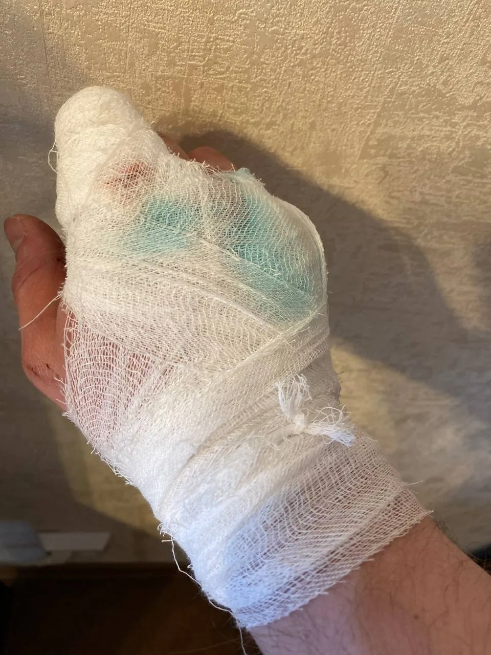 🤬😱 «Цепь, прут и самокат»: в Перми возбудили уголовное дело о нападении подростков на двух мужчин
