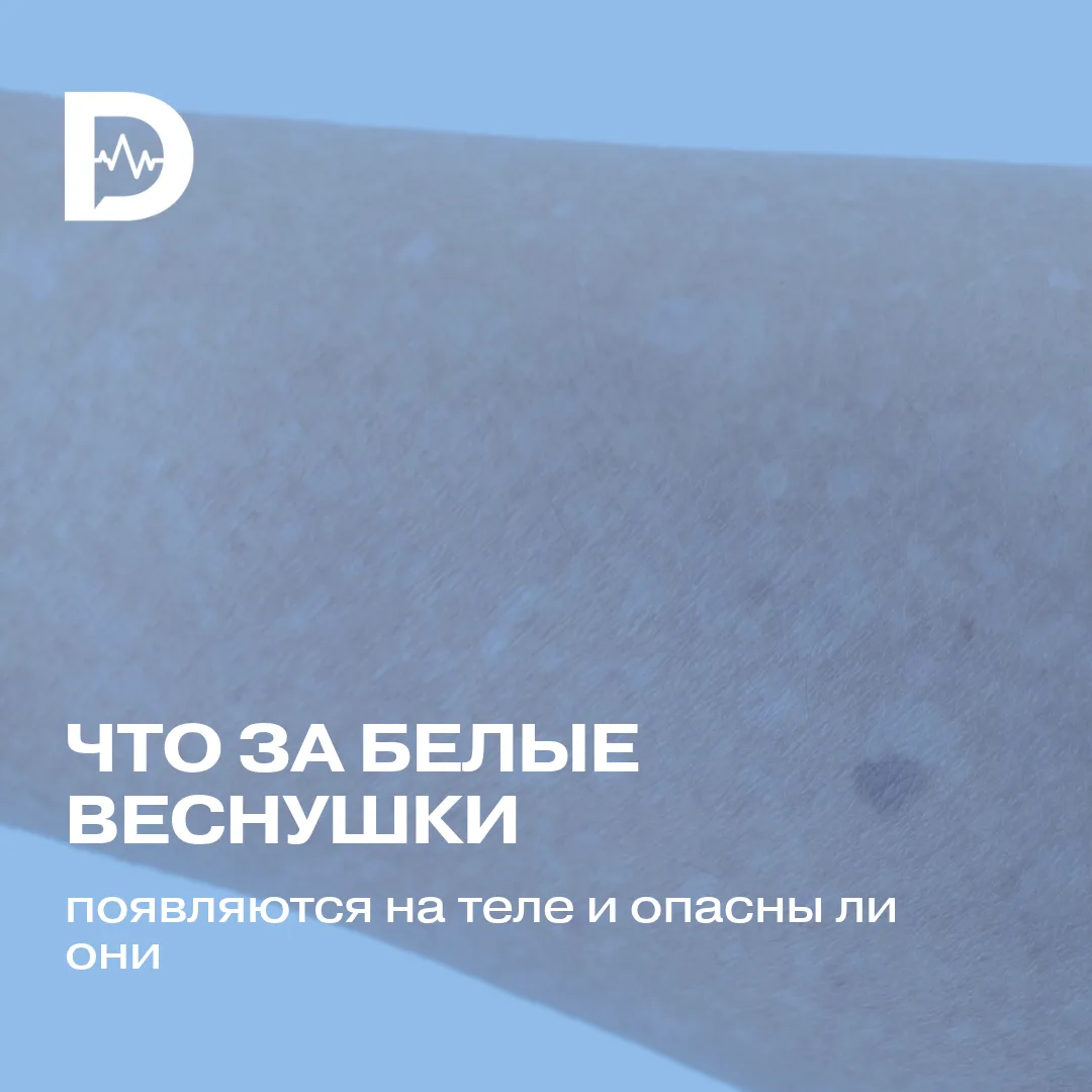 К обычным веснушкам, которые становятся более заметными весной, все привыкли. Но что, е...