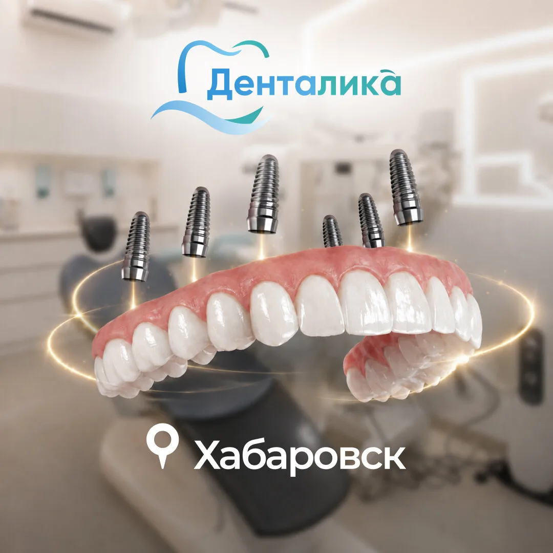 Протезирование всей челюсти от 9 992 ₽/мес. в рассрочку