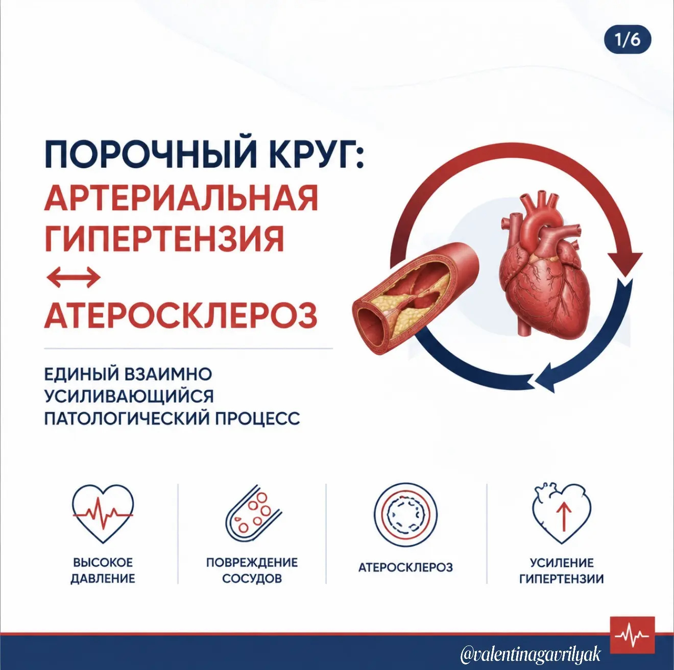 Порочный круг: артериальная гипертензия и атеросклероз.