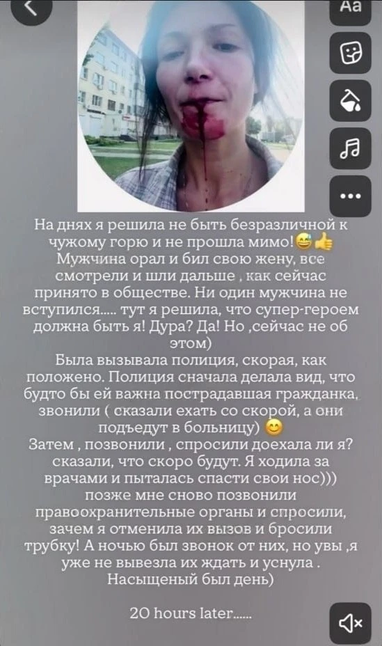 Воронежский неадекват избил жену и ударил девушку скейтбордом по лицу
