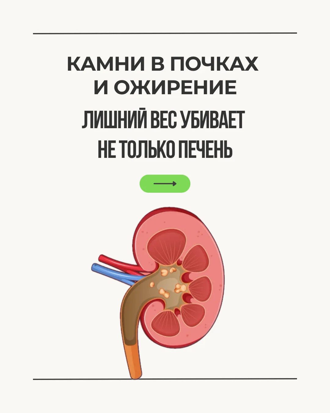 На консультации мужчина 45 лет, вес 112 кг. Пришёл по поводу похудения, но упомянул: